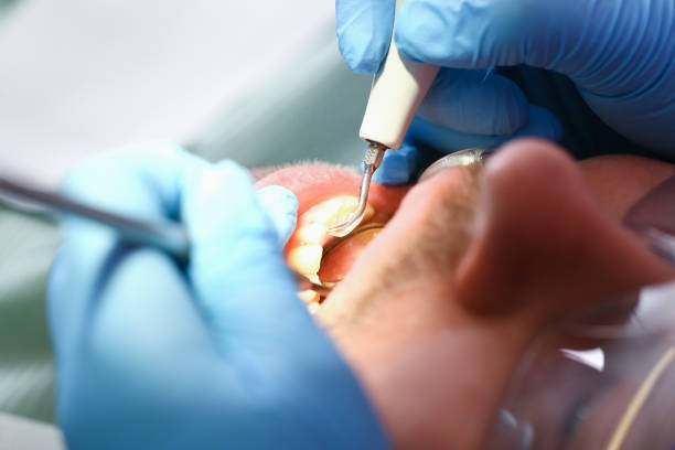 Best Pediatric Emergency Dentist in Ridgetop, TN
