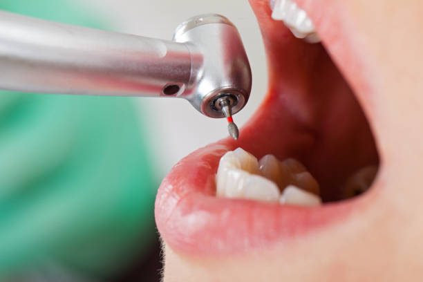 Best Emergency Treatment for Dental Infections or Abscesses in Ridgetop, TN